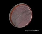 Corynebacterium diphtheriae colonies on agar plate